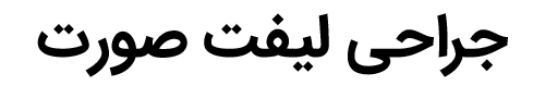 جراحی لیفت صورت دکتر مهدی خلج - drkhalaj.com
