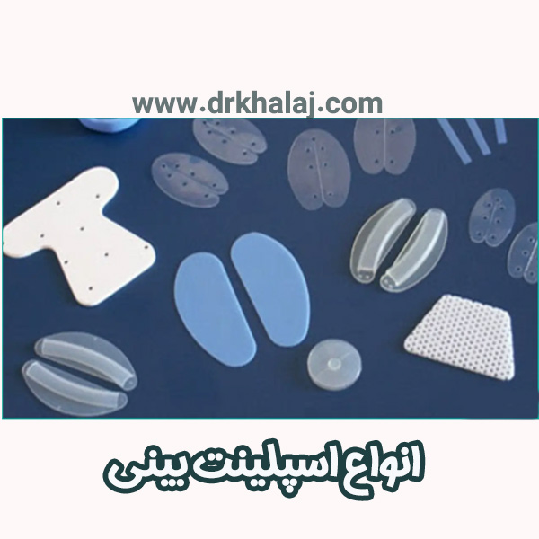 انواع اسپلینت