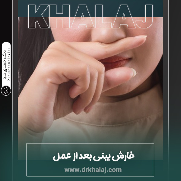 خارش بینی بعد از عمل