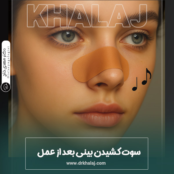 سوت کشیدن بینی بعد از عمل
