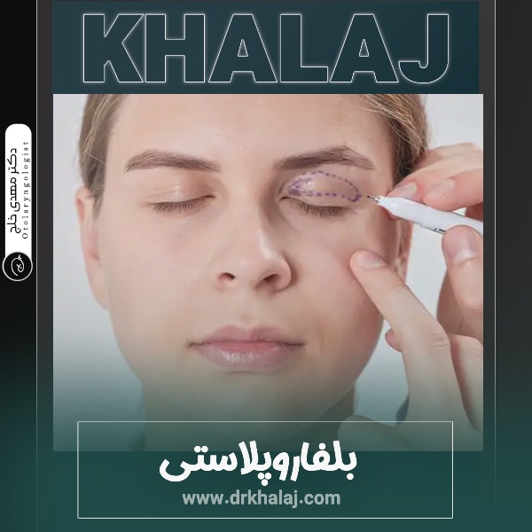 بلفاروپلاستی